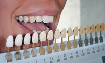 Skip the Charcoal Toothpaste Teeth Whitening is More Effective