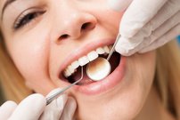 Teeth Cleaning: All of The Health Benefits You Receive