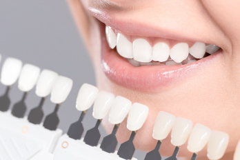 tooth whitening