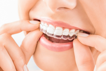 dental aesthetics
